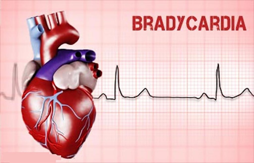 آشنایی با اصطلاحات پزشکی قلب 